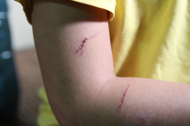 Những vết thương trên cơ thể bé trai 10 tuổi bị bạo hành ai nhìn thấy cũng xót xa-6