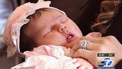 Sững sờ với bé gái sơ sinh mới chào đời đã... mọc 2 răng cửa
