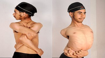 Vặn ngược đầu 180 độ từ trước ra sau