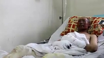 Nổ nhà máy thép, công nhân thoát chết hy hữu