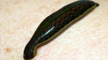 Cao Bằng: Gắp đỉa dài 10cm trong khí quản cụ bà 77 tuổi