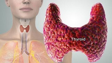Biểu hiện, dấu hiệu, triệu chứng ung thư tuyến giáp