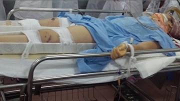 Hiện trường nữ sinh lớp 8 rơi từ biệt thự 5 tầng xuống đất tại Hà Nội