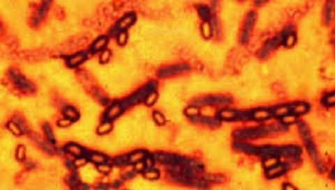 66 phòng thí nghiệm bị gửi nhầm vi khuẩn bệnh than