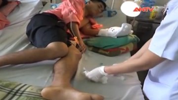 Can ngăn đánh nhau, nam thanh niên bị chém lìa tay