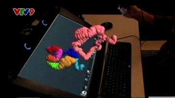 Tách bộ phận cơ thể để chẩn đoán 3D và điều trị bệnh tại Mỹ