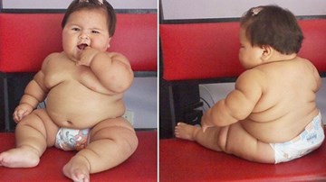 Bất ngờ với bé gái 10 tháng tuổi nặng như trẻ 5 tuổi