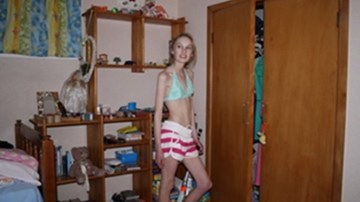 Sự hối hận muộn màng của cô gái mắc chứng rối loạn ăn uống