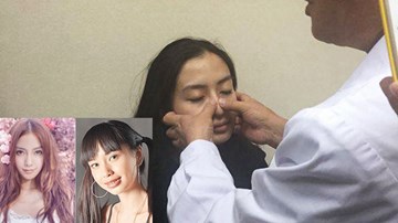 Cận cảnh Angelababy kiểm chứng nhan sắc chưa từng dao kéo