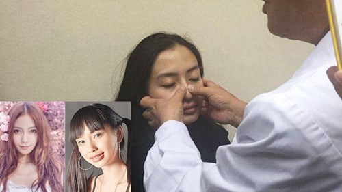 Cận cảnh Angelababy kiểm chứng nhan sắc chưa từng dao kéo