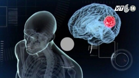 Phát hiện thuốc chữa ung thư từ vắc xin sốt rét