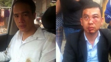 Công an Hà Nội tích cực điều tra vụ 2 luật sư bị hành hung