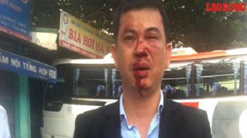 Khởi tố 7 bị can hành hung hai luật sư ở Chương Mỹ