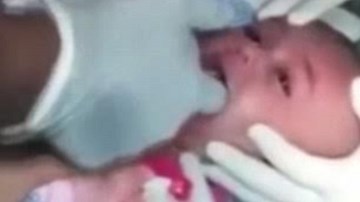 Nghẹt thở cảnh bé trai hóc... đồng hồ được bác sĩ cứu sống