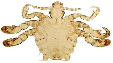 Rợn người cảnh rận mu ký sinh 3 tháng trên lông người