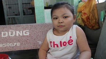 Cô gái 25 tuổi mang hình hài như trẻ lên 5