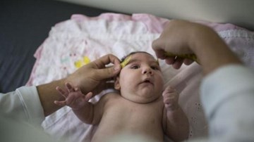 Tại sao sự bùng phát vi-rút Zika lại đe dọa phụ nữ mang thai?
