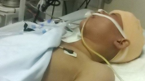 Học sinh bị đánh chấn thương sọ não trước cổng trường sức khỏe vẫn rất yếu