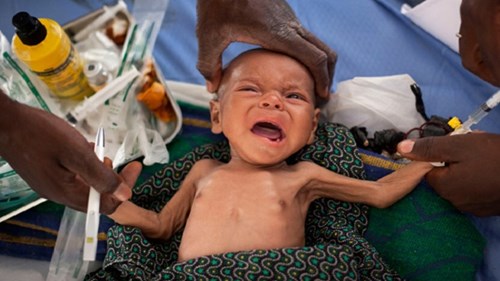 Bí kíp chế biến món ngon bổ dưỡng cho trẻ còi xương