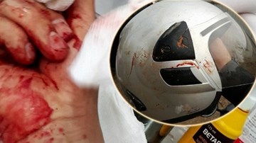 Bộ TT&TT vào cuộc vụ nhà báo Đỗ Doãn Hoàng bị hành hung