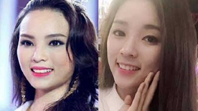 Kỳ Duyên khoe vẻ sexy sau nghi án thẩm mỹ gọt cằm