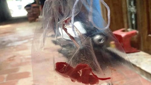 Hà Nội: Đình chỉ bác sỹ 'quên gạc sau phẫu thuật'