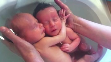 Xúc động cặp sinh đôi không biết mình đã chào đời