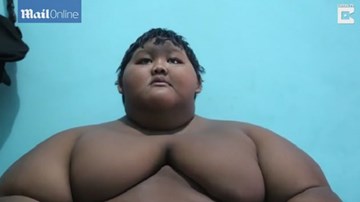 Cậu bé 10 tuổi nặng...192 kg tại Indonesia