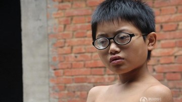 Sự thật về cậu bé 11 tuổi cận 2.000 độ ở Trung Quốc