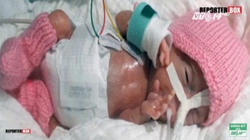 Bé sơ sinh nhỏ nhất thế giới nặng 0,2kg