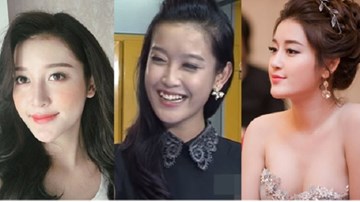 Á hậu Huyền My nói về nhan sắc kém xinh trước khi thi hoa hậu