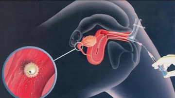 Đã xác định được bố cháu bé trong vụ nữ tử tù mang thai