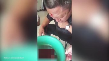 Trán chảy máu ồ ạt sau khi bác sỹ châm cứu chữa bệnh đau đầu