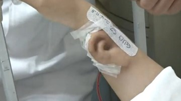 Bác sĩ Trung Quốc 'trồng' tai giả trên cánh tay bệnh nhân