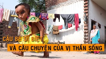 Cậu bé dị biệt và câu chuyện của một vị thần sống