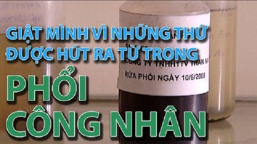 Giật mình vì những thứ được hút ra từ trong phổi công nhân