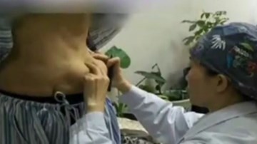 Hậu phẫu thuật nâng cấp vòng 1, tá hỏa phát hiện ngực... rơi xuống bụng