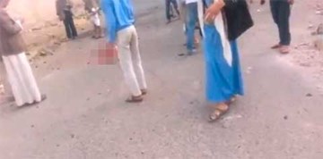 Kẻ đánh bom IS vẫn sống sau khi mất nửa người