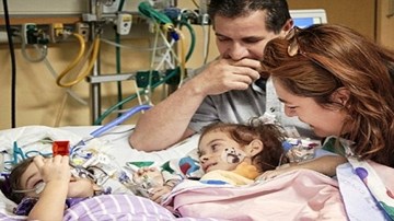 Cặp song sinh thích thú nhìn nhau sau khi được phẫu thuật tách rời