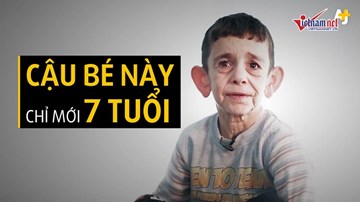 Cậu bé 7 tuổi bị 'giam cầm' trong hình dạng ông già 70