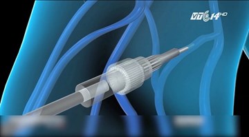 Những khả năng gây mê có thể gây chết người