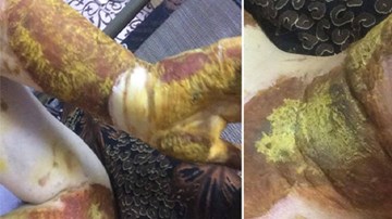 Vụ nữ sinh bị bỏng ở trường: Hiệu trưởng muốn chặn báo chí