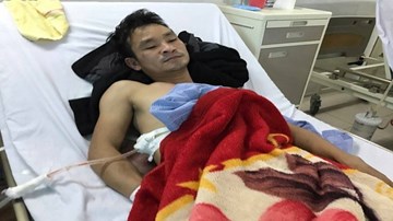 Thanh niên cứu người bị đâm thấu phổi: Triệu tập nghi can gây án