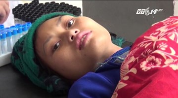 Hà Giang: 53 người nhập viện nghi do ngộ độc thực phẩm