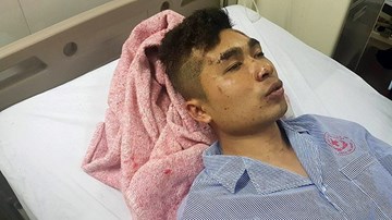Nhân chứng vụ nổ xe khách: Cơ thể tôi bay từ cuối lên đầu xe