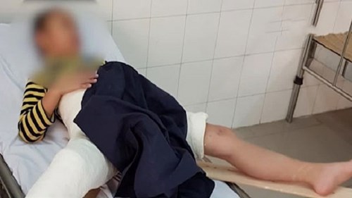 Học sinh bị đâm gãy chân trong sân trường: Sự thật qua lời kể của học sinh