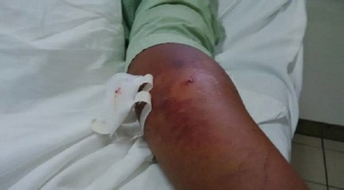 Rắn độc ồ ạt bò ra ngoài hang tấn công người
