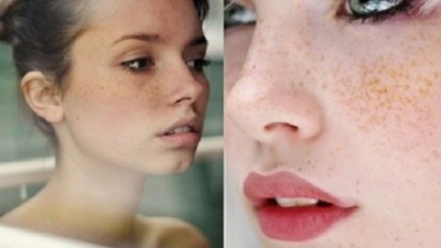 Giới trẻ phát cuồng trào lưu xăm... tàn nhang làm đẹp