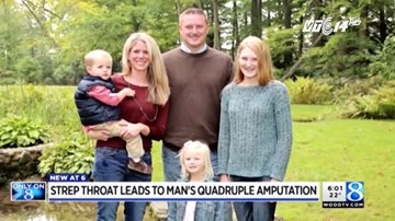 Bệnh lạ tại Mỹ: Chỉ vì viêm họng mà cụt tứ chi