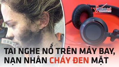 Nổ tai nghe trên máy bay, nữ hành khách cháy đen mặt